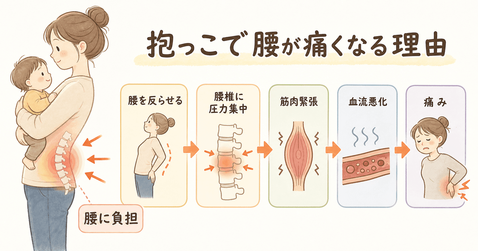 抱っこで腰が痛くなる理由:仕組みから理解しようの図解