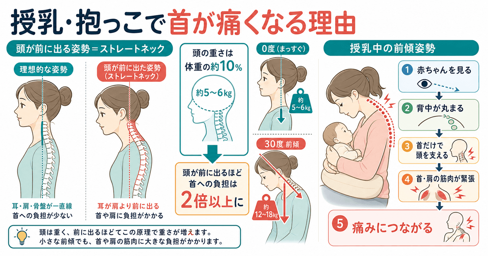 授乳・抱っこで首が痛くなる理由:頭の前傾と筋肉への負担