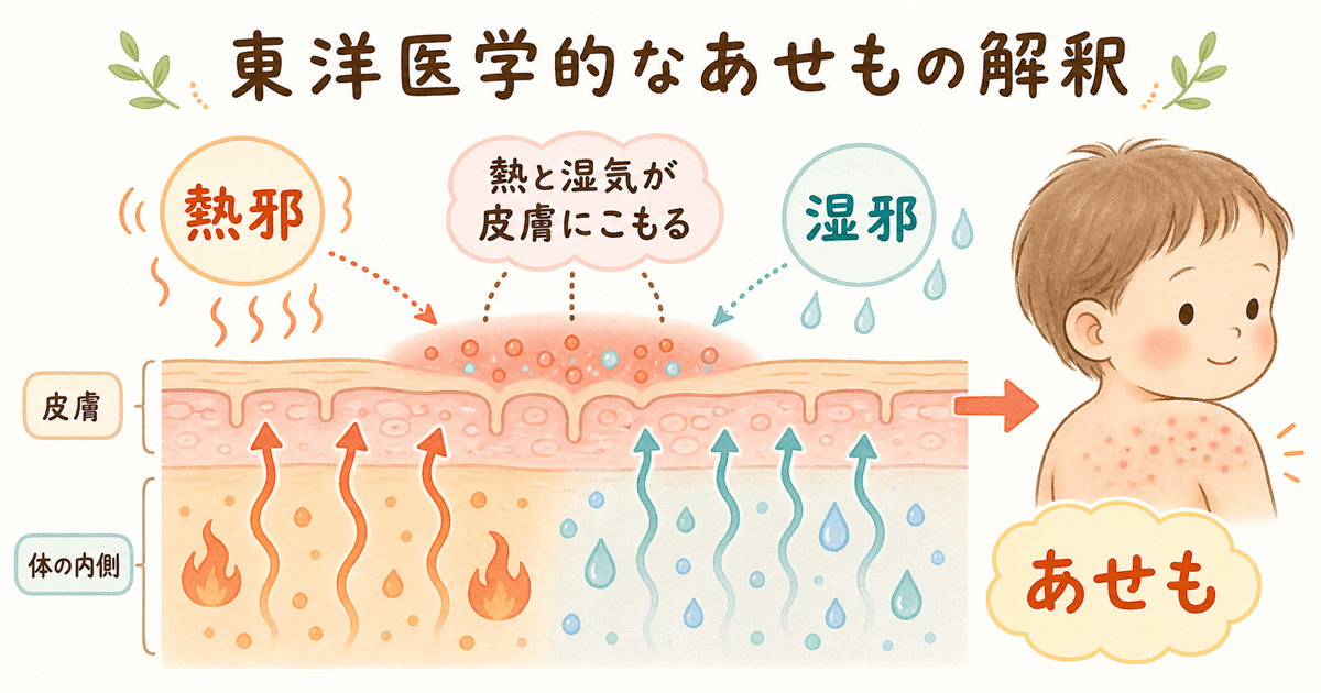 東洋医学的なあせもの解釈：熱邪と湿邪の問題