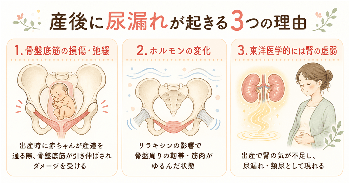 産後に尿漏れが起きる3つの理由
